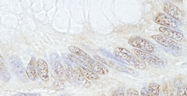 TRIM33/TIF1gamma Antibody in Immunohistochemistry (IHC)