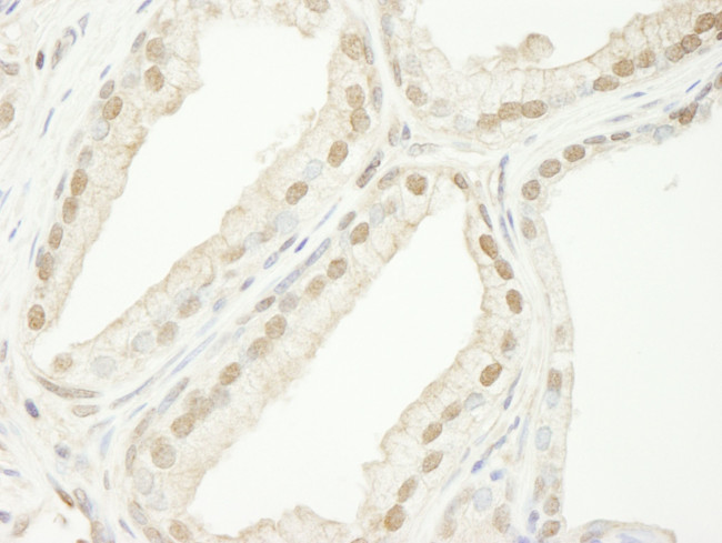 TRIM33/TIF1gamma Antibody in Immunohistochemistry (IHC)