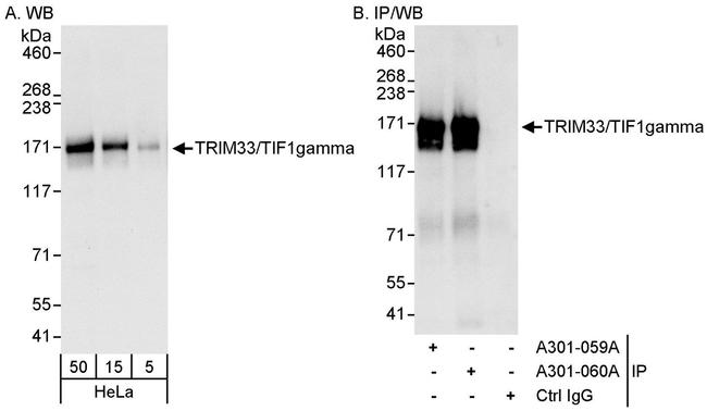 TRIM33/TIF1gamma Antibody in Western Blot (WB)