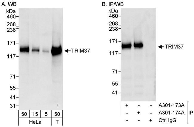 TRIM37 Antibody in Western Blot (WB)