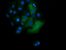 TRIM38 Antibody in Immunocytochemistry (ICC/IF)