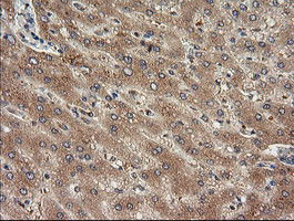 TRIM38 Antibody in Immunohistochemistry (Paraffin) (IHC (P))