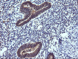 TRIM38 Antibody in Immunohistochemistry (Paraffin) (IHC (P))