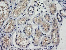 TRIM38 Antibody in Immunohistochemistry (Paraffin) (IHC (P))