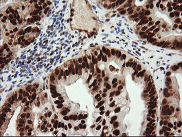 TRIM38 Antibody in Immunohistochemistry (Paraffin) (IHC (P))