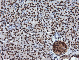 TRIM38 Antibody in Immunohistochemistry (Paraffin) (IHC (P))