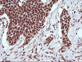 TRIM38 Antibody in Immunohistochemistry (Paraffin) (IHC (P))