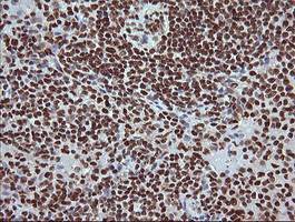 TRIM38 Antibody in Immunohistochemistry (Paraffin) (IHC (P))