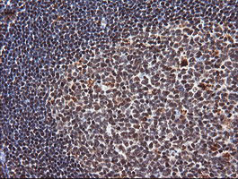 TRIM38 Antibody in Immunohistochemistry (Paraffin) (IHC (P))