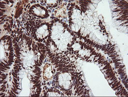 TRIM38 Antibody in Immunohistochemistry (Paraffin) (IHC (P))