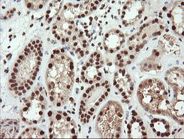 TRIM38 Antibody in Immunohistochemistry (Paraffin) (IHC (P))