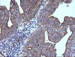 TRIM38 Antibody in Immunohistochemistry (Paraffin) (IHC (P))