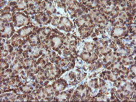 TRIM38 Antibody in Immunohistochemistry (Paraffin) (IHC (P))