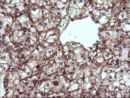 TRIM38 Antibody in Immunohistochemistry (Paraffin) (IHC (P))