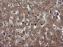 TRIM38 Antibody in Immunohistochemistry (Paraffin) (IHC (P))