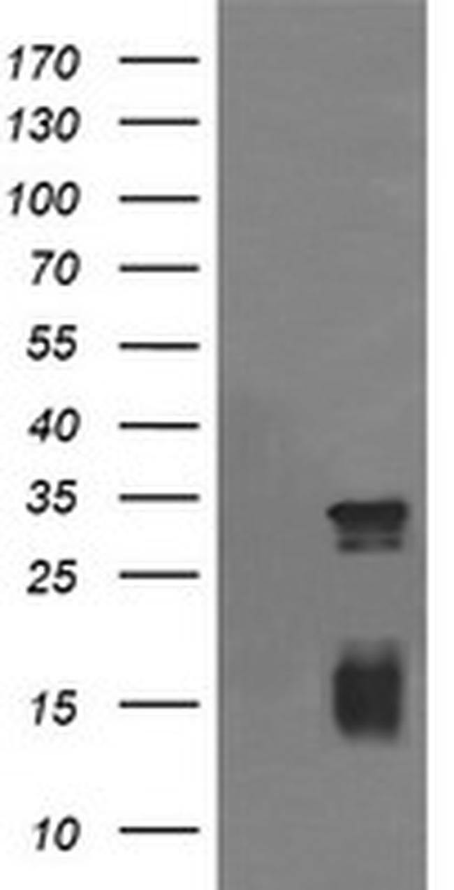 TRIM38 Antibody in Western Blot (WB)