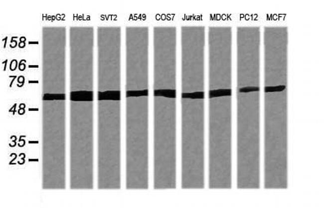 TRIM38 Antibody in Western Blot (WB)