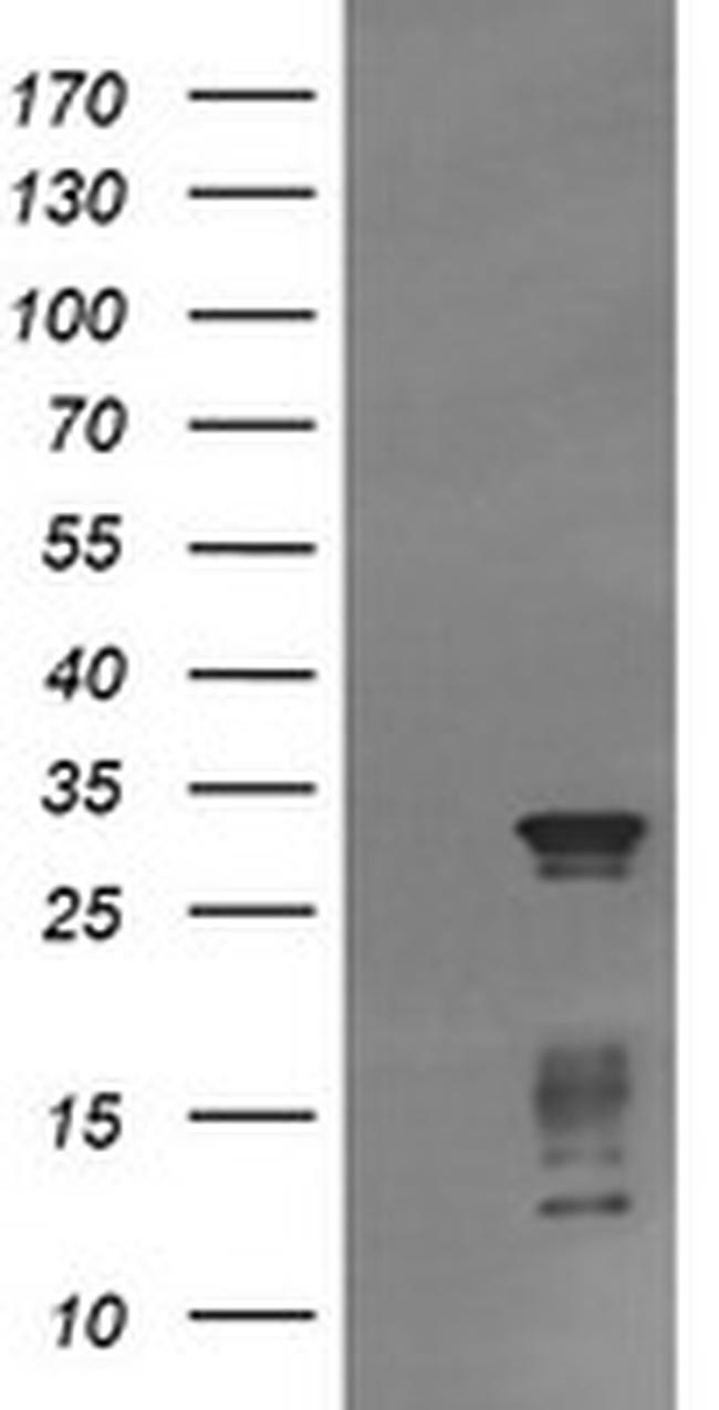 TRIM38 Antibody in Western Blot (WB)