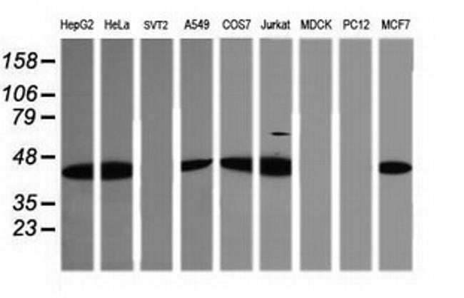 TRIM38 Antibody in Western Blot (WB)