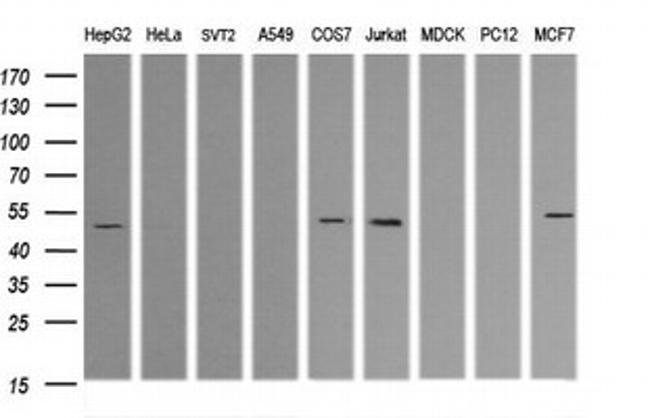 TRIM38 Antibody in Western Blot (WB)