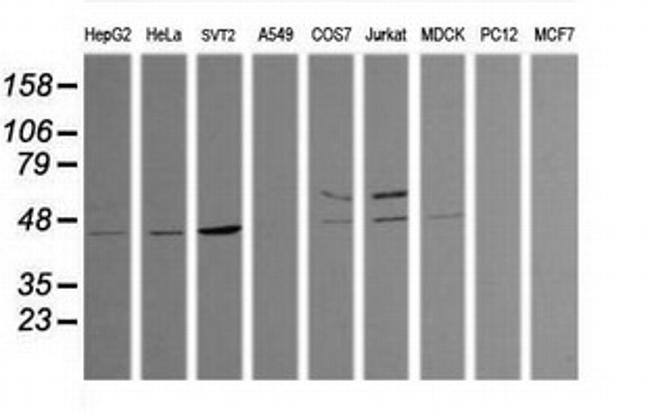 TRIM38 Antibody in Western Blot (WB)