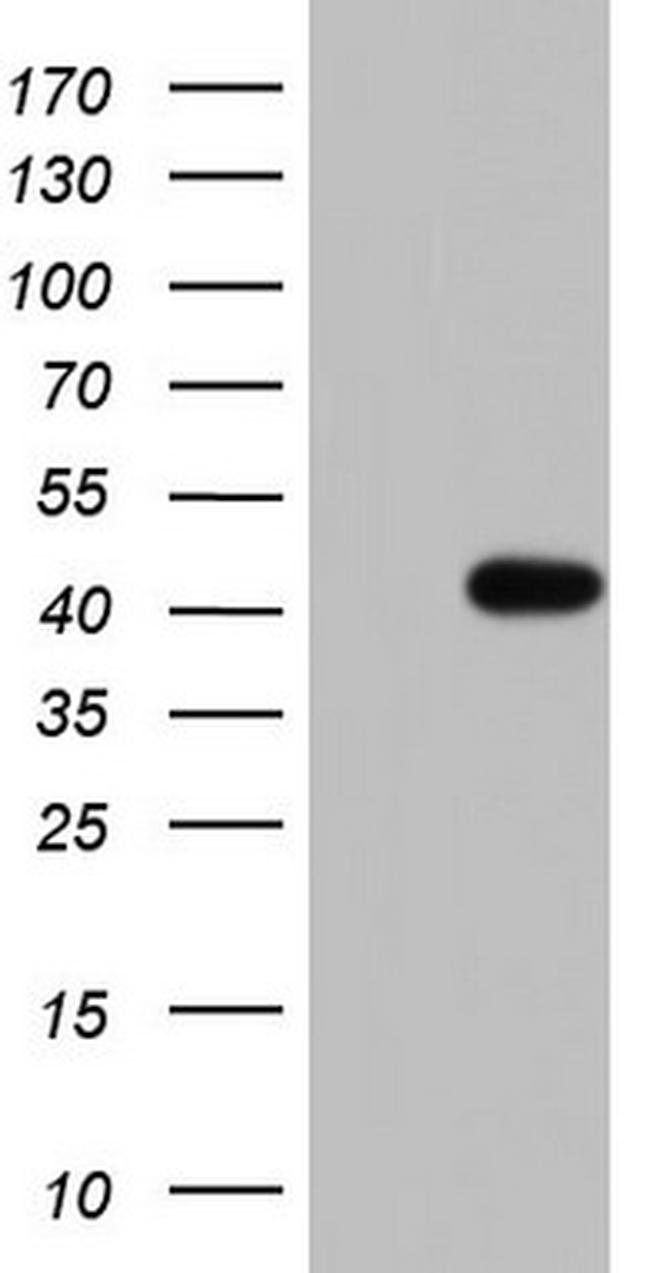 TRIM54 Antibody in Western Blot (WB)