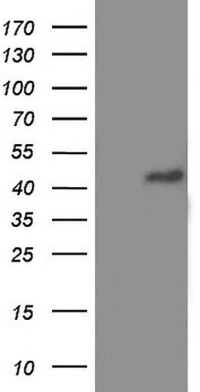 TRIM54 Antibody in Western Blot (WB)