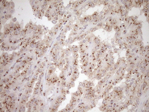 TRIM56 Antibody in Immunohistochemistry (Paraffin) (IHC (P))