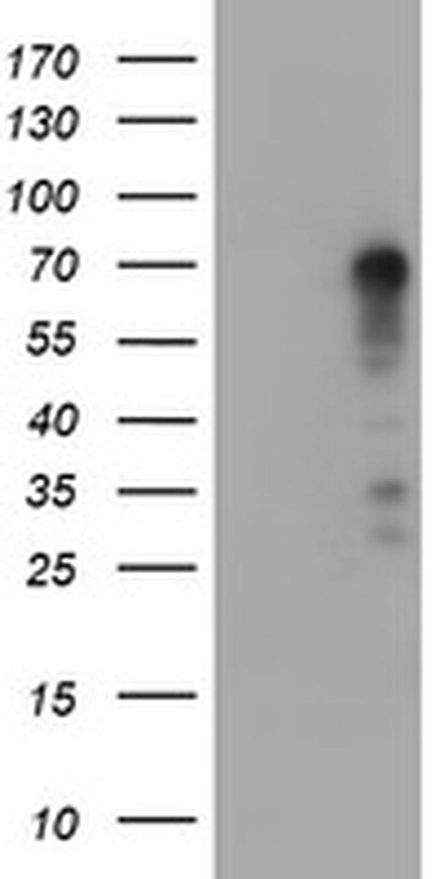 TRIM9 Antibody in Western Blot (WB)