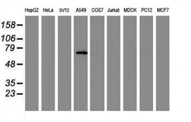 TRIM9 Antibody in Western Blot (WB)