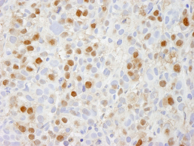 TRIP1/SUG1 Antibody in Immunohistochemistry (IHC)