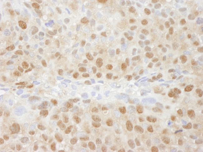 TRIP1/SUG1 Antibody in Immunohistochemistry (IHC)