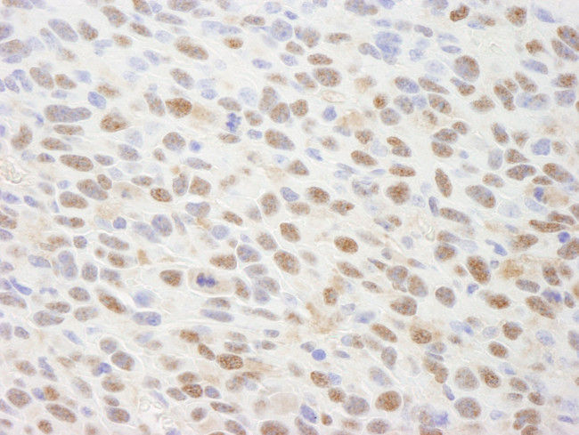 TRIP1/SUG1 Antibody in Immunohistochemistry (IHC)