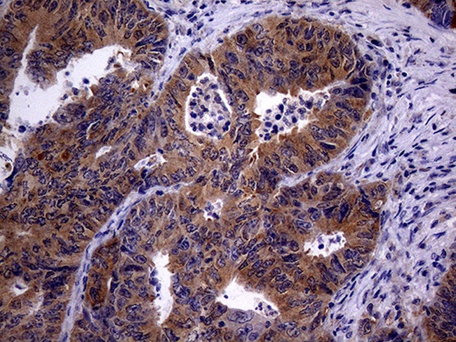 TRIP13 Antibody in Immunohistochemistry (Paraffin) (IHC (P))