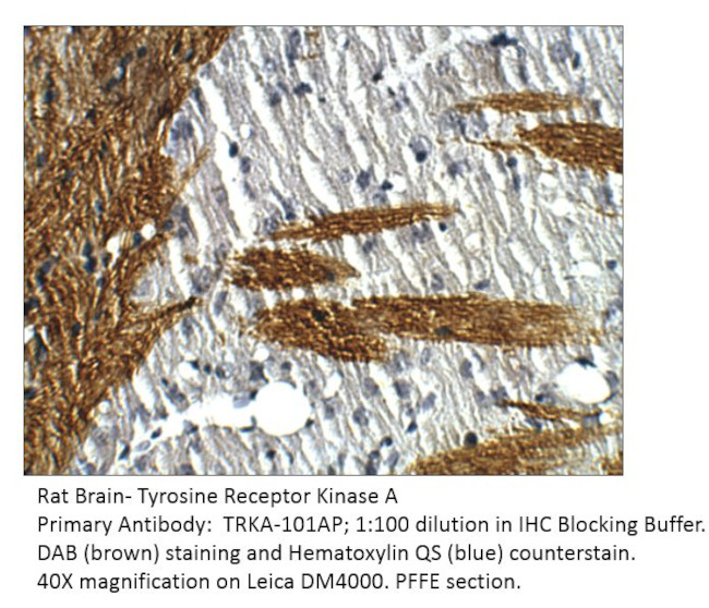 TrkA Antibody in Immunohistochemistry (IHC)