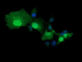 TRMT2A Antibody in Immunocytochemistry (ICC/IF)