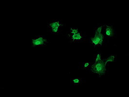 TRMT2A Antibody in Immunocytochemistry (ICC/IF)