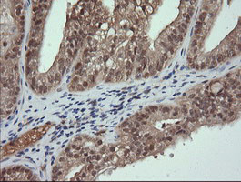 TRMT2A Antibody in Immunohistochemistry (Paraffin) (IHC (P))