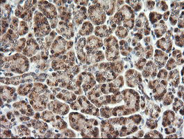 TRMT2A Antibody in Immunohistochemistry (Paraffin) (IHC (P))