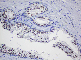 TRMT2A Antibody in Immunohistochemistry (Paraffin) (IHC (P))