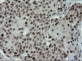 TRMT2A Antibody in Immunohistochemistry (Paraffin) (IHC (P))