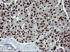 TRMT2A Antibody in Immunohistochemistry (Paraffin) (IHC (P))