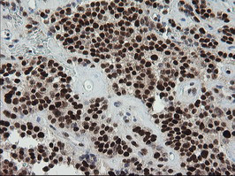 TRMT2A Antibody in Immunohistochemistry (Paraffin) (IHC (P))