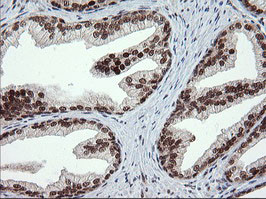 TRMT2A Antibody in Immunohistochemistry (Paraffin) (IHC (P))