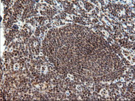 TRMT2A Antibody in Immunohistochemistry (Paraffin) (IHC (P))