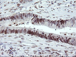 TRMT2A Antibody in Immunohistochemistry (Paraffin) (IHC (P))