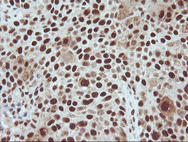 TRMT2A Antibody in Immunohistochemistry (Paraffin) (IHC (P))