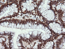 TRMT2A Antibody in Immunohistochemistry (Paraffin) (IHC (P))