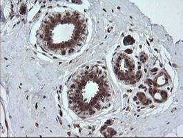 TRMT2A Antibody in Immunohistochemistry (Paraffin) (IHC (P))