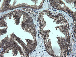 TRMT2A Antibody in Immunohistochemistry (Paraffin) (IHC (P))